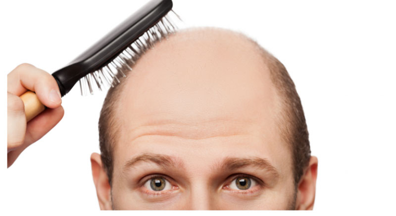 Things to Know Before Choosing the Best Hair Transplant Clinic in Mumbai