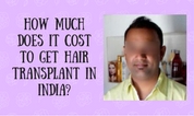 How much does it cost to get hair transplant in India?
