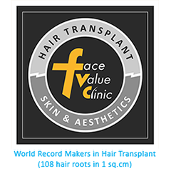 What to choose In Between Hair Weaving and Hair Transplant? - Face Value  Hair Clinic Blogs