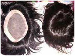 Camouflaging tricks - Face Value Clinic | Hair Transplant in Mumbai