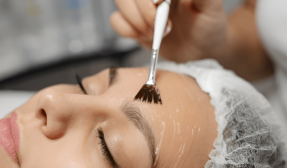 Chemical Peel Treatment - Face Value