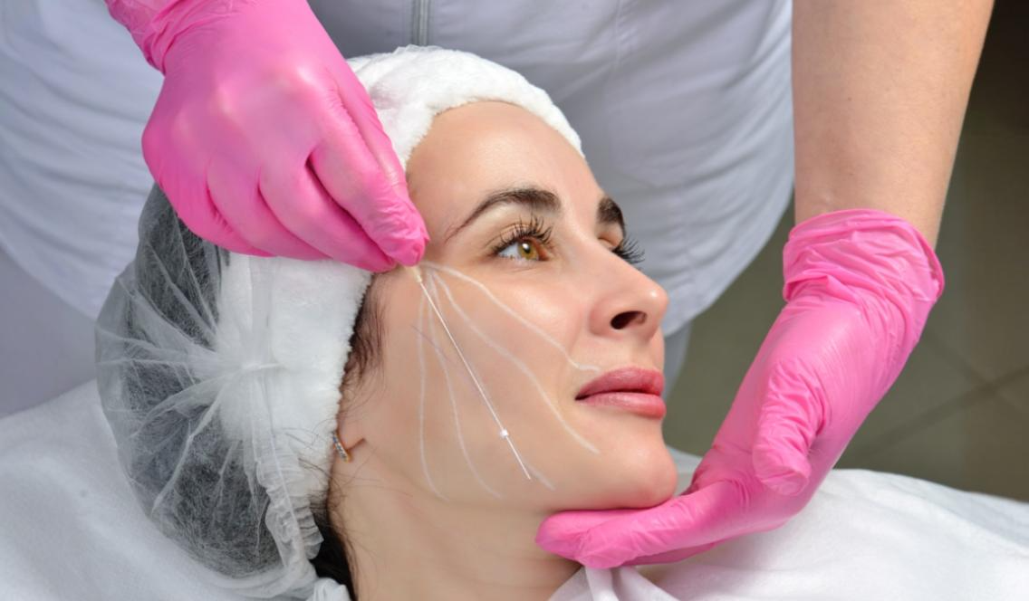 Thread Lift Treatment - Face Value