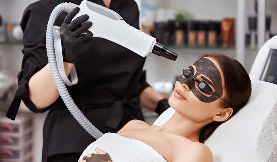 Carbon Laser Peel Treatment - Face Value